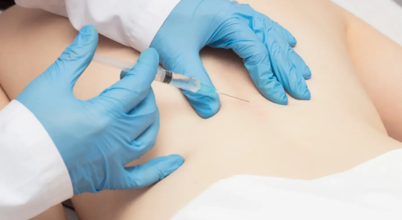 PRP Therapy at Essential Spine Interventions